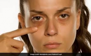 आंखों के नीचे दिखने वाले डार्क सर्कल्स से छुटकारा दिलाती हैं ये 6 चीजें, काले घेरे होने लगते हैं हल्के